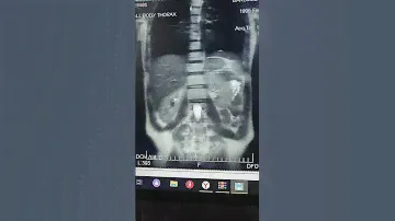 😏Попробуй угадай , что это такое .Уверен почти все подумали типично.Отправь другу . #МРТ